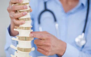 doctor holding spine model